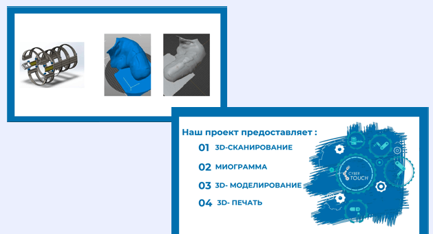 Протез верхней конечности